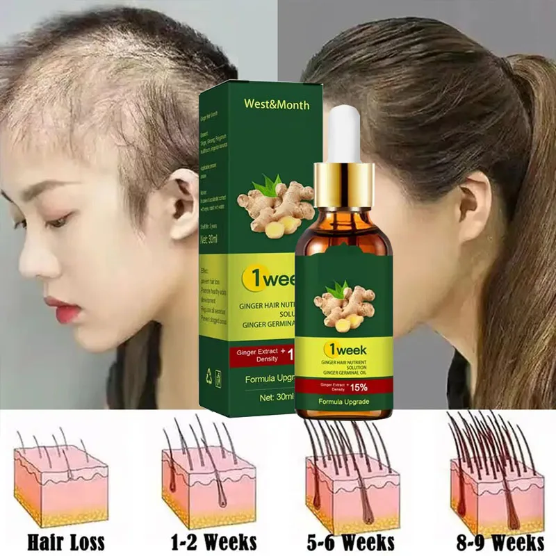 7 gün zencefil saç büyüme ürün - Licorice Root Sticks incelemesi ve fiyatı